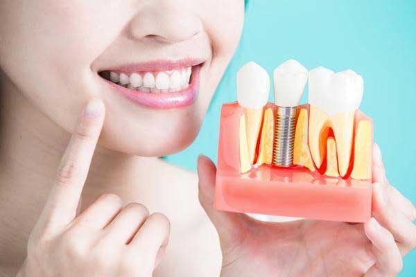 mejores implantes dentales zaragoza